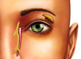 Ophthalmic Diseases Treatement Image